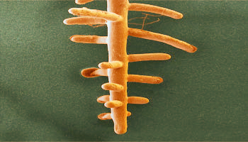Mycorrhiza- Fungal roots