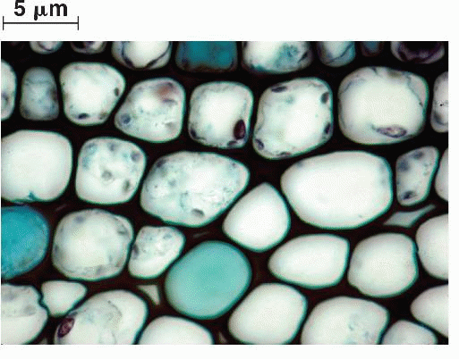Collenchyma cells