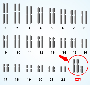 Extra X chromosome